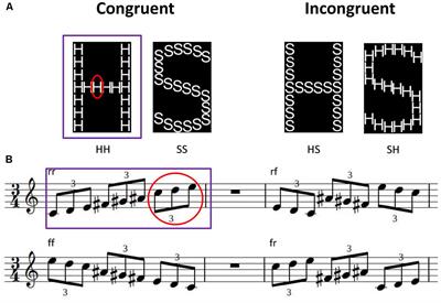 A Tendency Towards Details? Inconsistent Results on Auditory and Visual Local-To-Global Processing in Absolute Pitch Musicians